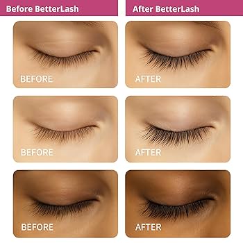 Amazon.com: BetterLash Lash Growth Serum - Natural Peptide